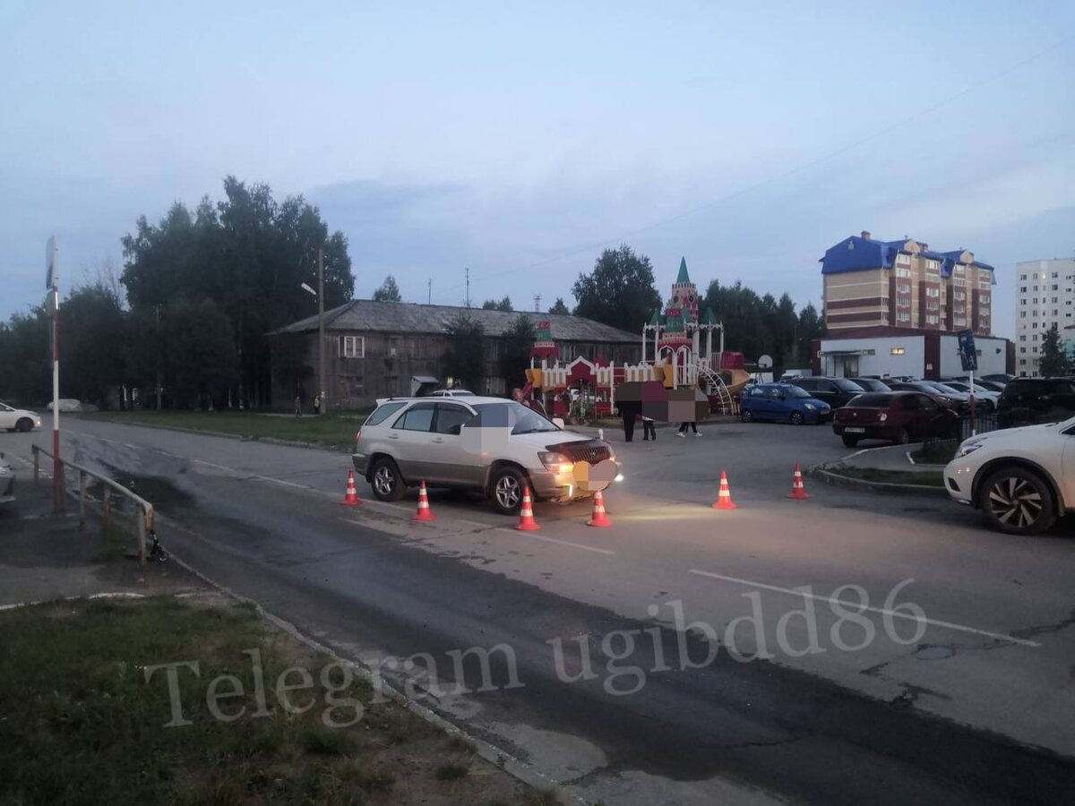    В Мегионе ребенок на самокате попал под колеса автомобиля