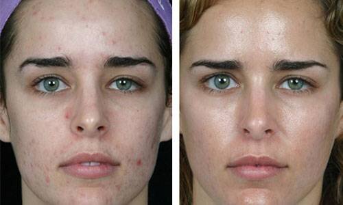 
Средство отлично очищает кожу, нейтрализует активность болезнетворных микробов