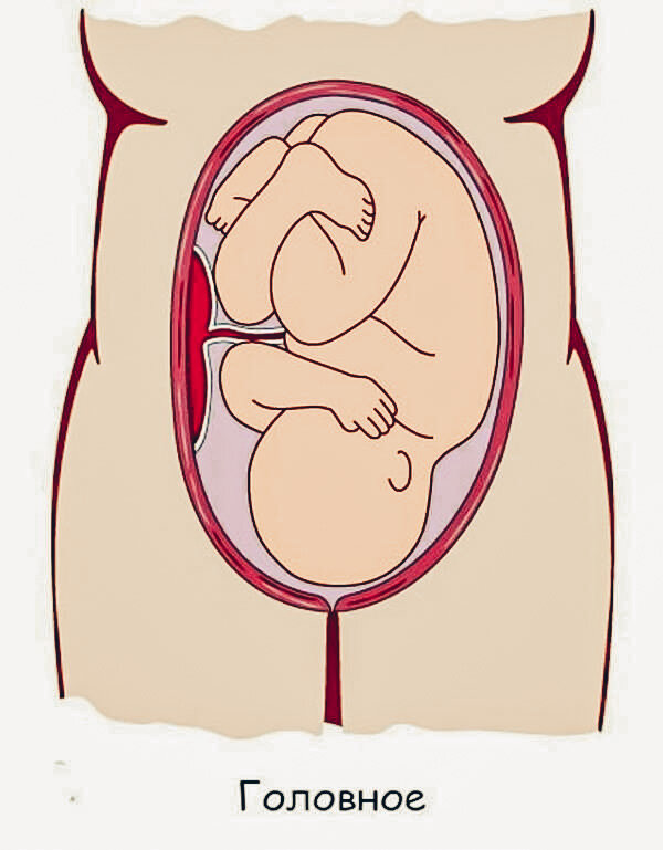 Правильное положение малыша