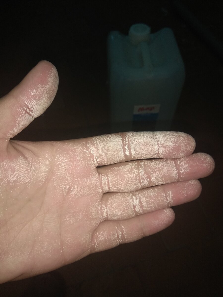 Ожог как от перекиси