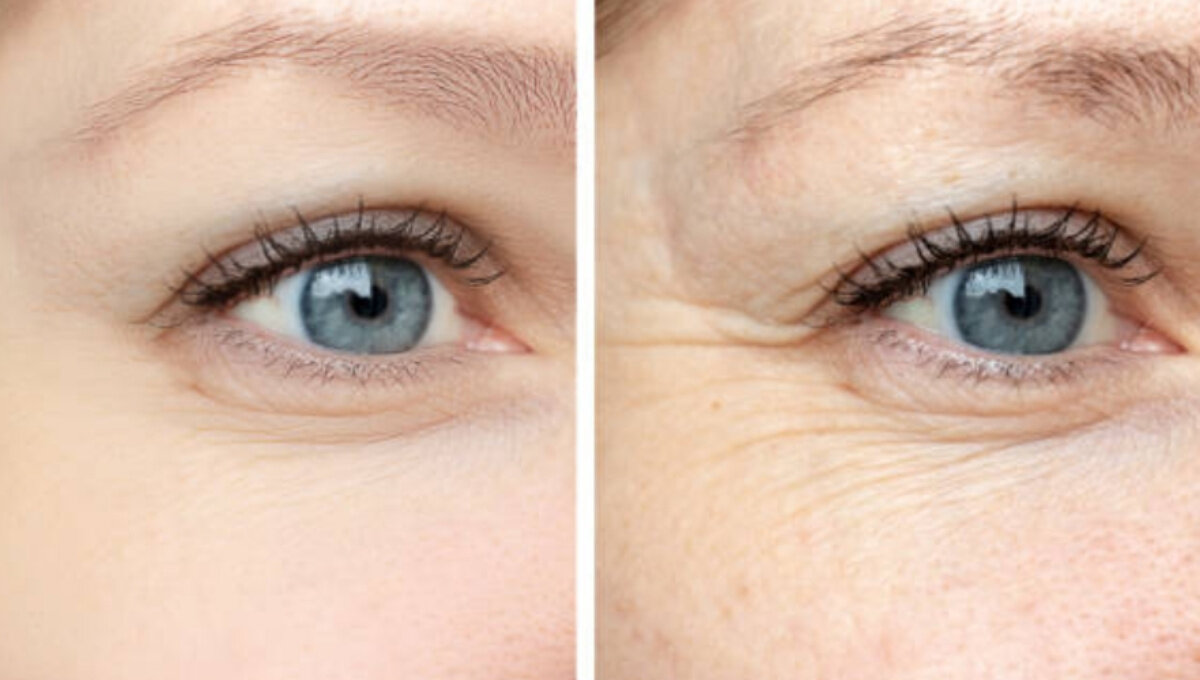 Старение кожи лица