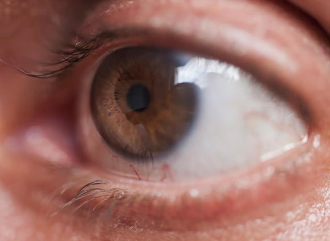 Глазная болезнь глаукома. Глаукома начальная стадия. Глазная глаукома симптомы. Глаукома внутриглазное. Причины глаукомы глаза