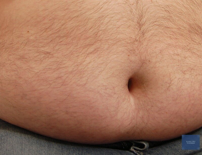 Мохнатый живот) Наверное пивной живот