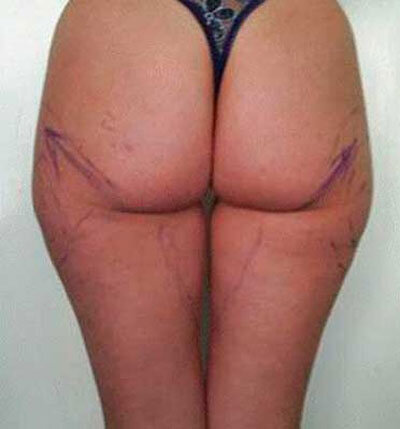 До комплекса процедур