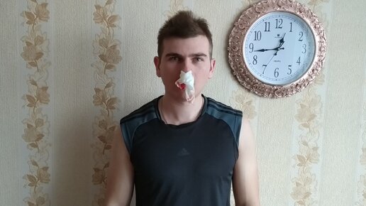 Каждый день идёт кровь из носа | Бабиджон | Дзен