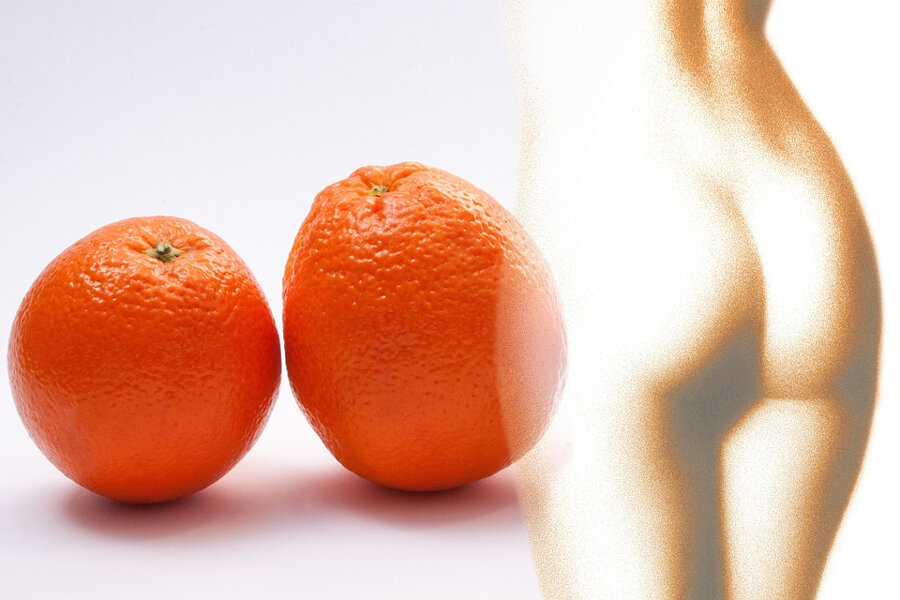 Целлюлит
