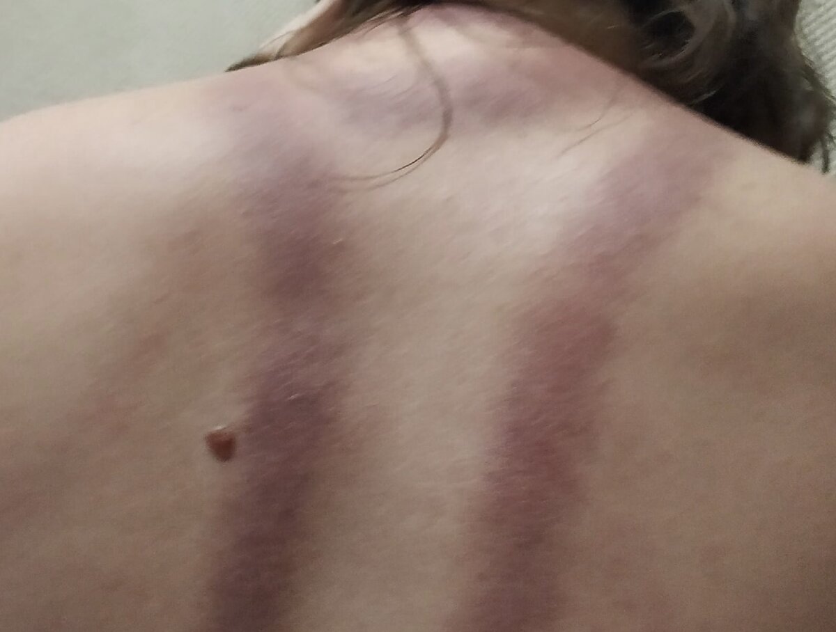 После 10-го заключительного сеанса массажа