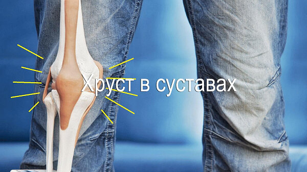 Хруст в суставах лечебная гимнастика. Хруст в суставах – причины симптома, виды, диагностика и лечение. Физические упражнения при радикулите: по методу Бубновского, гимнастика. Хруст и боль в суставах: основные причины, лечение, профилактика.