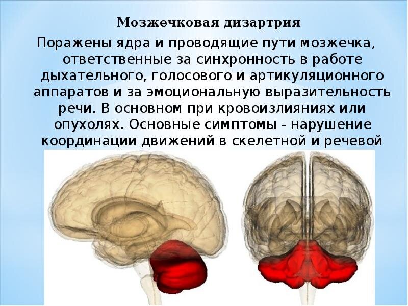 Дизартрия: что это, у детей и взрослых, виды, формы, лечение, причины, симптомы