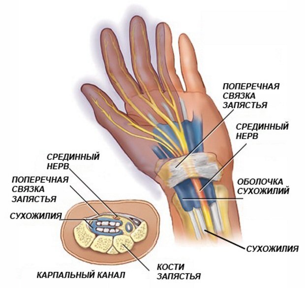 Перенапряжение мышц