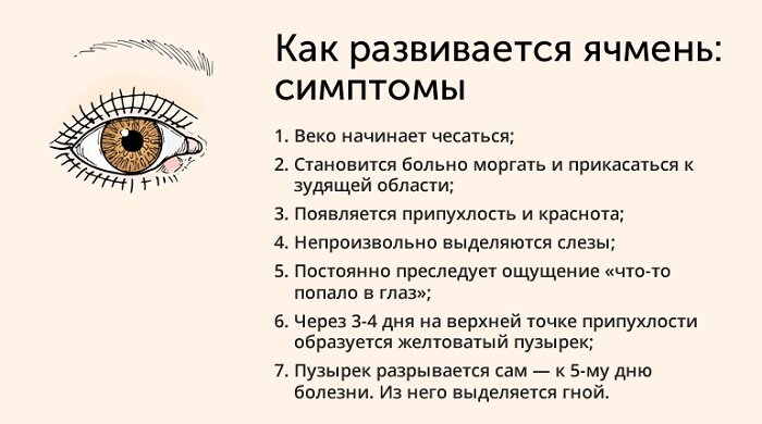 10 МЕТОДОВ БОРЬБЫ С ЯЧМЕНЕМ НА ГЛАЗУ