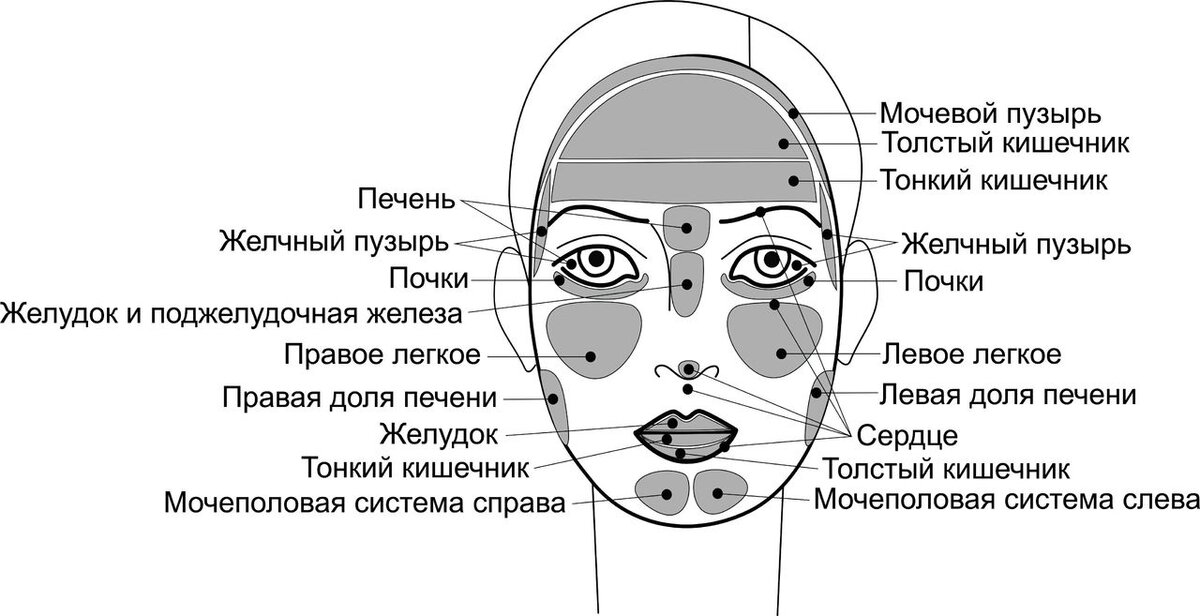 Прыщи схема расположения