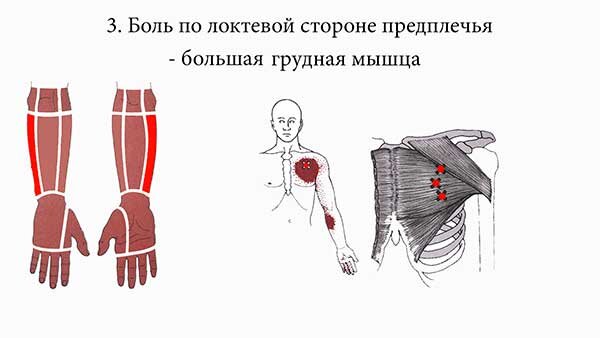 Боли в спине, что покажет МРТ и КТ диагностика? - donttk.ru