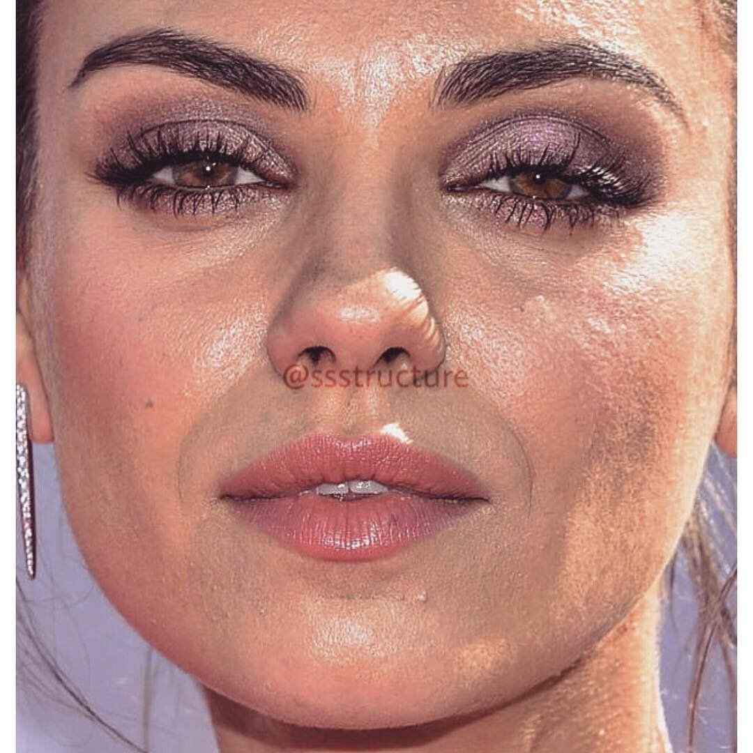 Неидеальная кожа лица. Кольца венеры на шее у звезд. Кожа лица вблизи. Неидеальная кожа лица. Блейк лайвли лицо крупным планом.