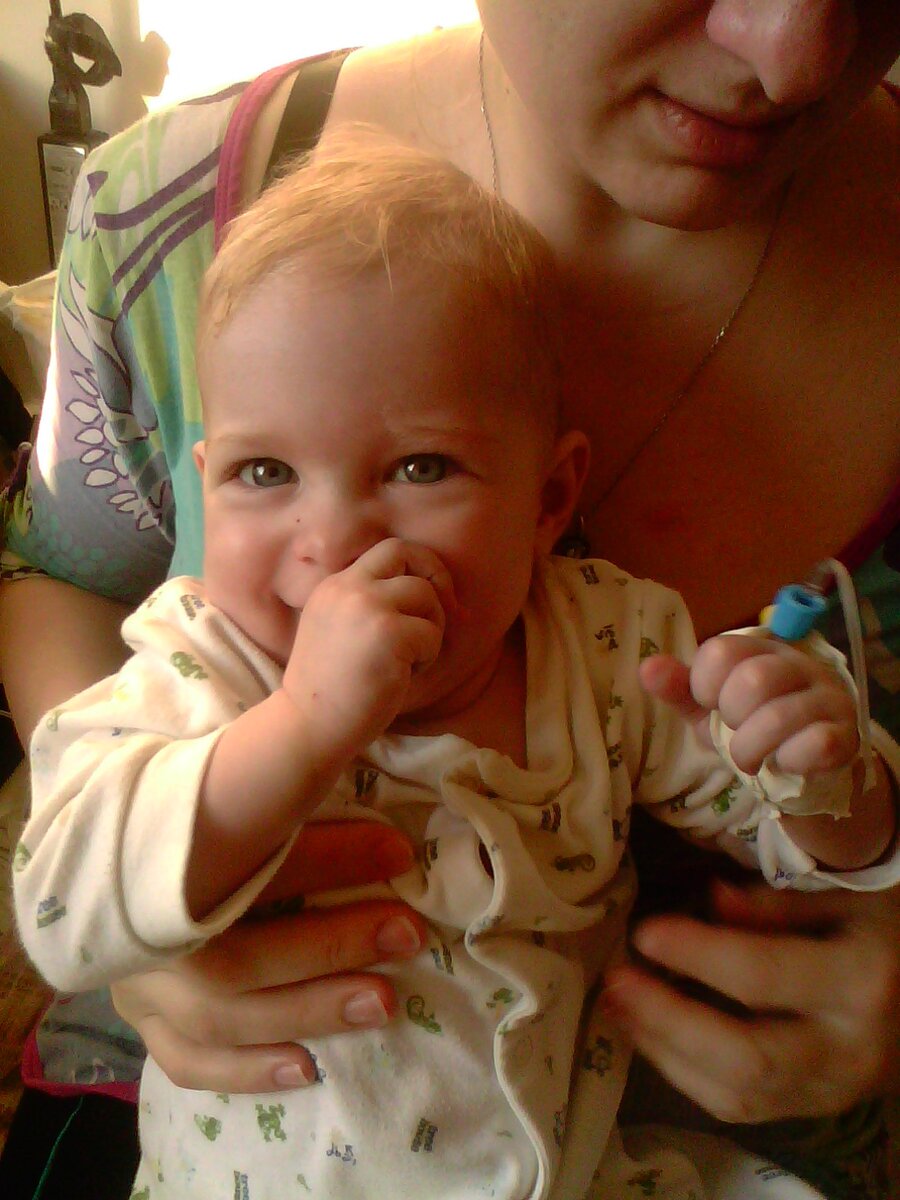 13.04.2013 На правой руке точки от катетера, на левой руке стоит катетер.