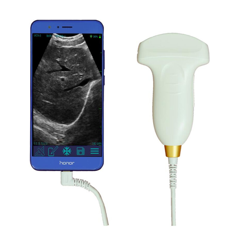 USB УЗИ к смартфону. Фото hiprove.com