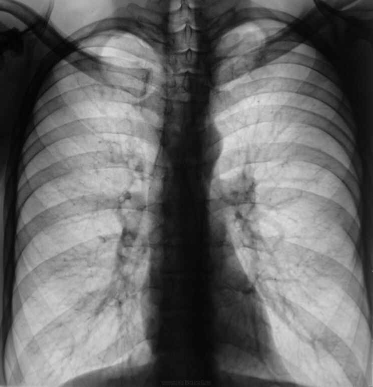 Яндекс картинки 