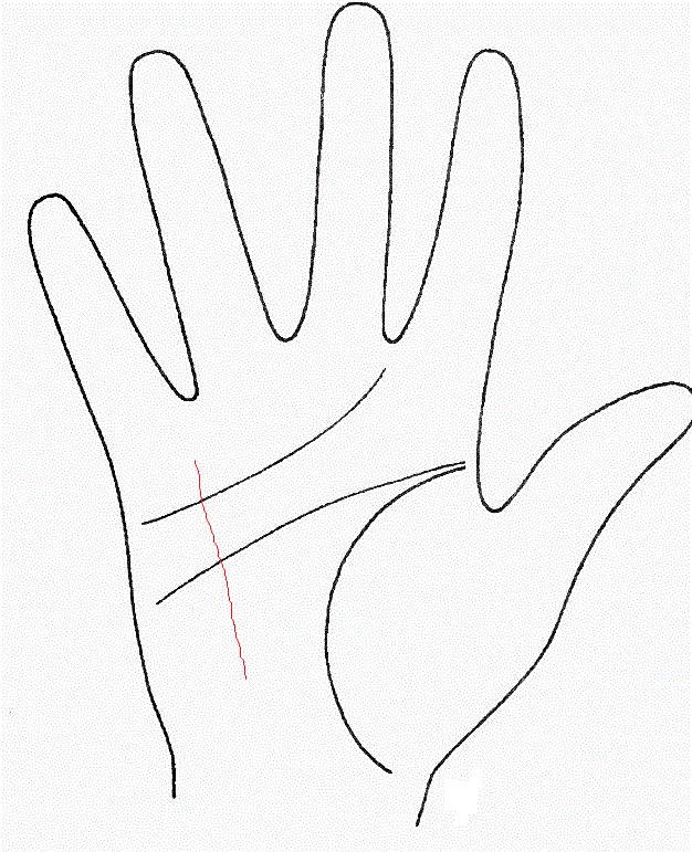 Слабо выраженная линия жижни