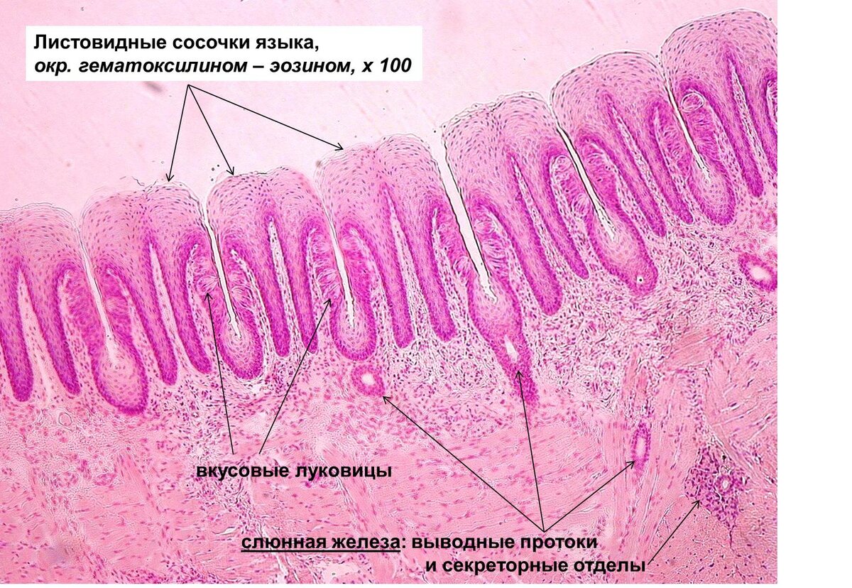 Нитевидные сосочки языка препарат гистология. Листовидные сосочки гистология препарат. Сосочки языка гистология препарат. Листовидный сосочек языка гистология.