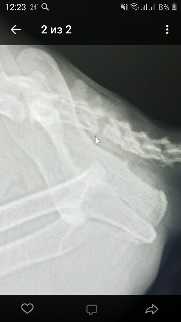 Сюрприз на рентгене