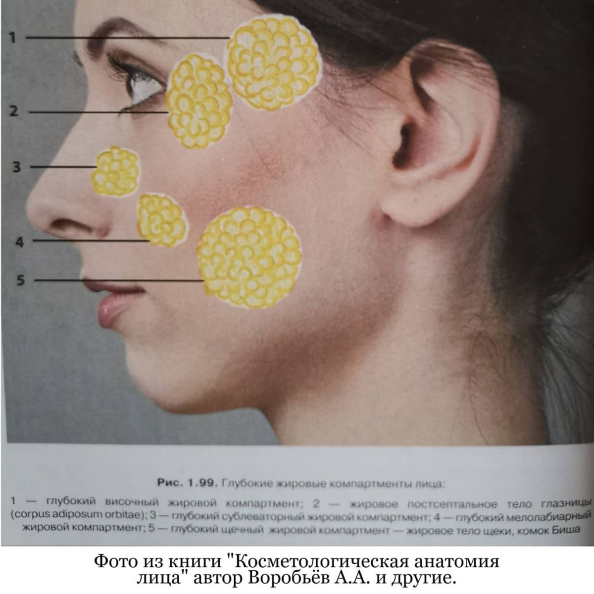 Жировое тело щеки. Расположение комков Биша. Комочки Биша расположение.