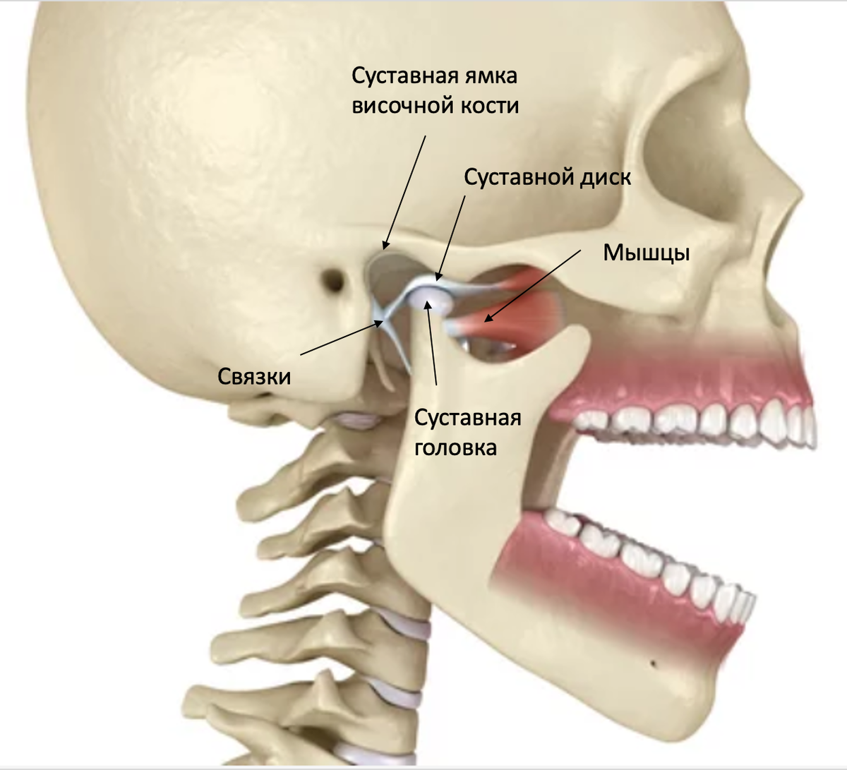 Челюстной сустав. Челюстью(дисфункция ВНЧС). ВНЧС анатомия. Суставной отросток ВНЧС. Дисфункция височно-нижнечелюстного сустава.