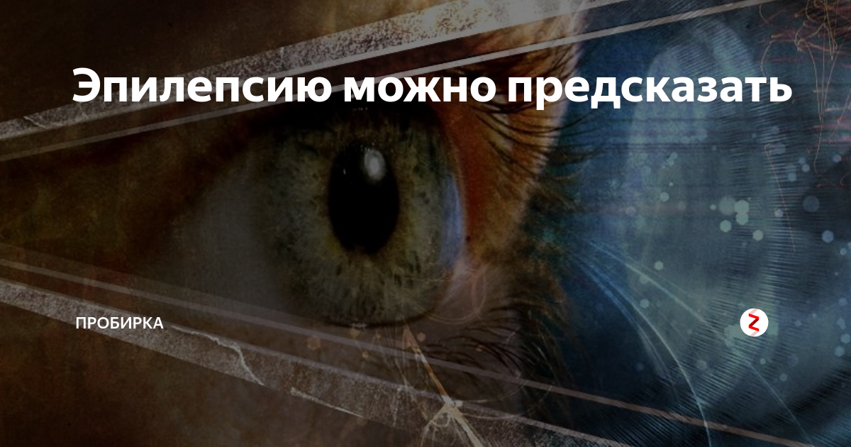Эпилепсию можно предсказать | ПРОБИРКА | Дзен