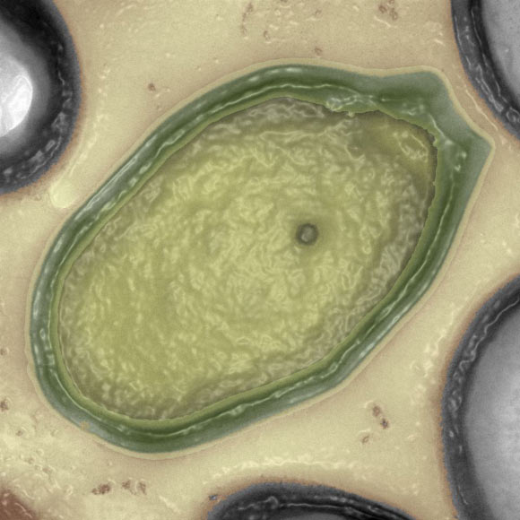 Pandoravirus salinus . Источник изображения: IGS CNRS-AMU