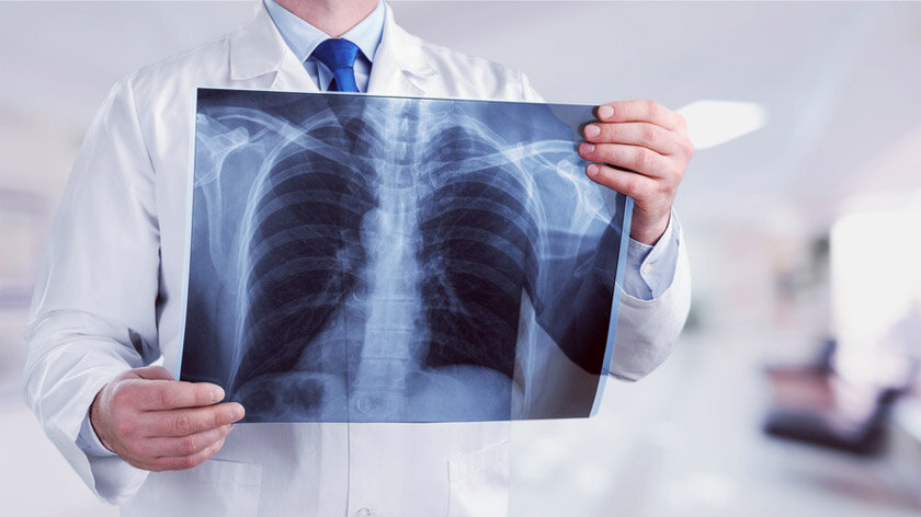 Фото: http://ec.europa.eu