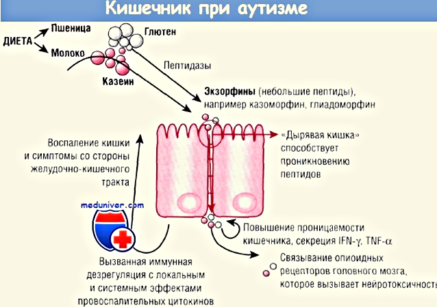 Синдром дырявого кишечника симптомы и лечение. Проницаемость слизистой оболочки кишечника. Синдром проницаемости кишечника. Кишечная проницаемость. Синдром повышенной кишечной проницаемости.