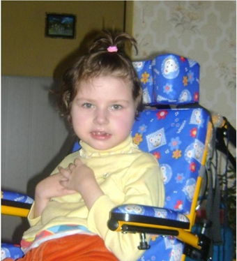 Синдром Ретта — одно из наиболее распространенных заболеваний в ряду наследственных форм умственной отсталости у девочек 