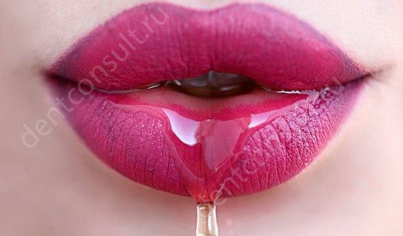 Фото: dentconsult.ru