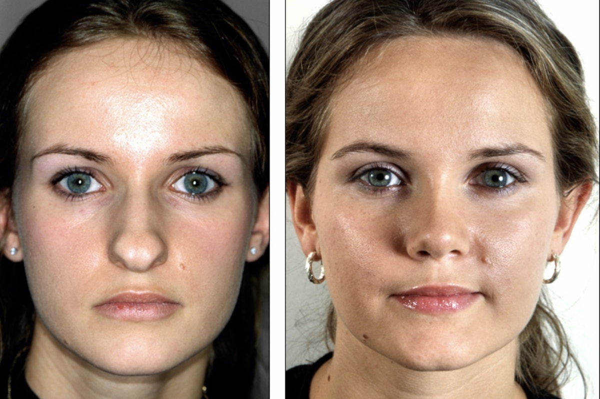 Фото с интернета