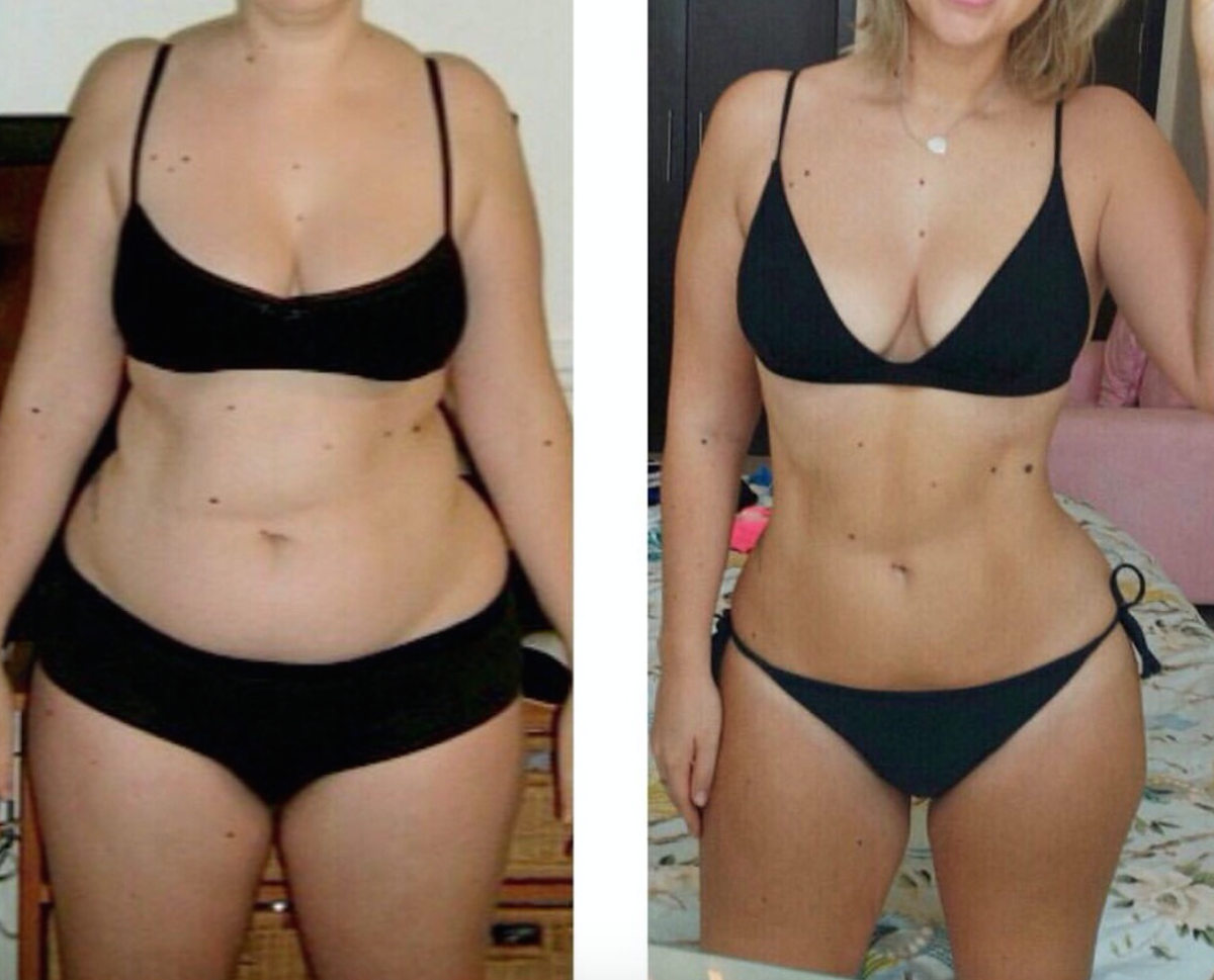 Сильно скинул. Похудение до и после. Живот до и после похудения. Результаты похудения. До и после похудения девушки.