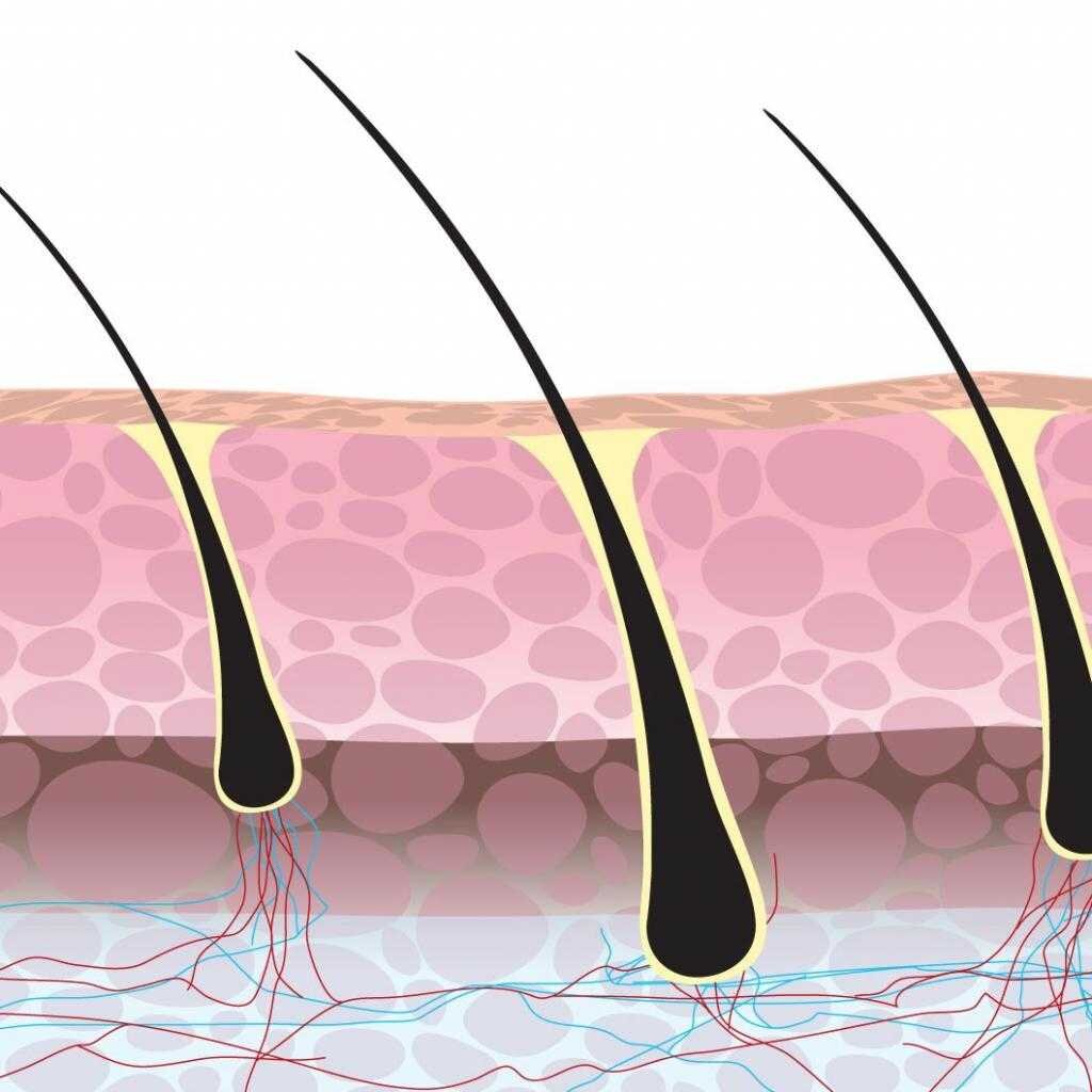Волосяной фолликул электроэпиляция. Фолликул анаген. Волосяная луковица. Фолликул волоса.