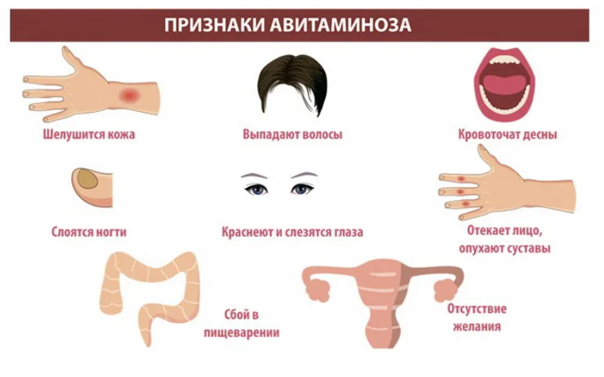 Нехватка витамина а симптомы. Признаки витаминаминоза. Дефицит витамина а симптомы.