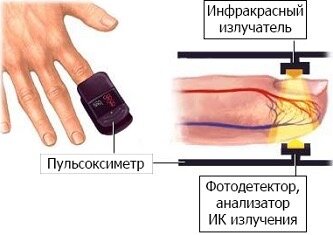 Как работает пульсоксиметр 