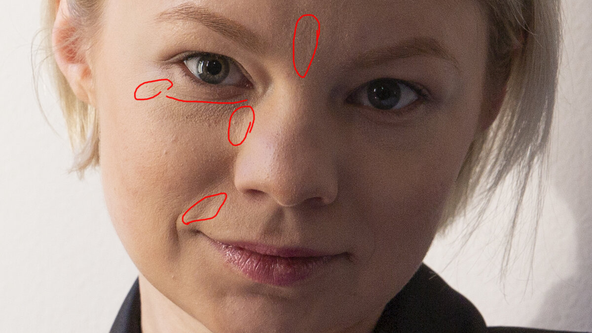 До. Не нашла более крупного фото, что и понятно. Кому охота фотографироваться, когда кожа в плохом состоянии?