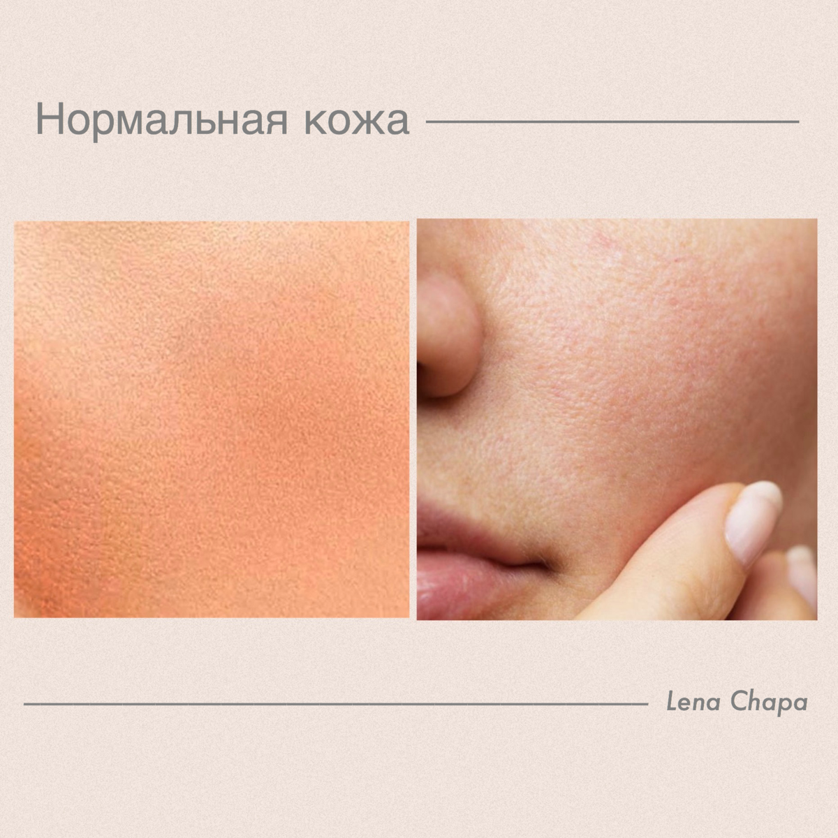 Нормальный тип кожи. Как определить сухую кожу. Как определить сухую кожу. Тип кожи сухая жирная. Определить тип кожи лица.