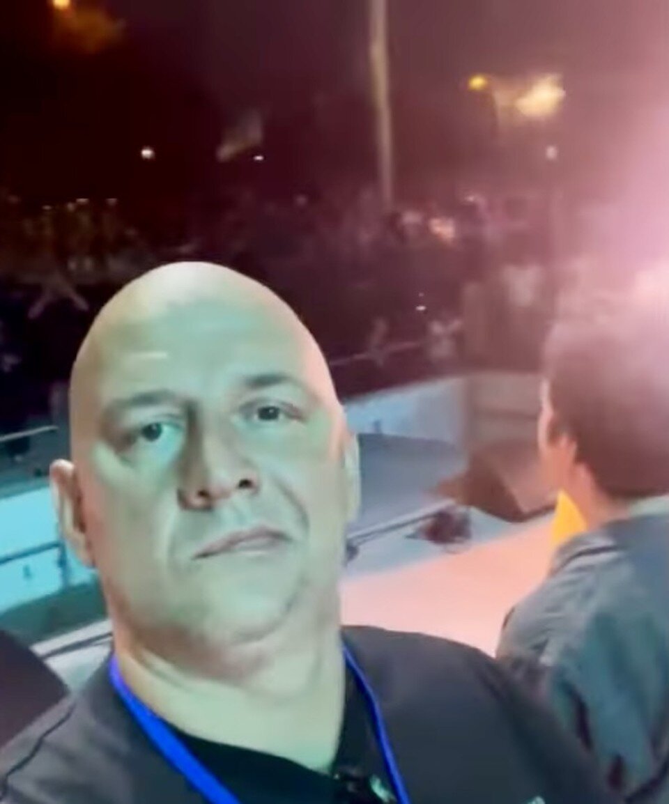     У Потапа парализовало половину лица.  из соцсетей