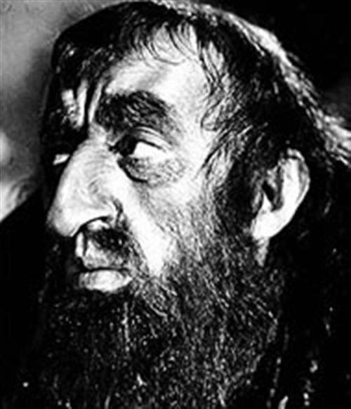 Пример формы носа «клюва попугая»