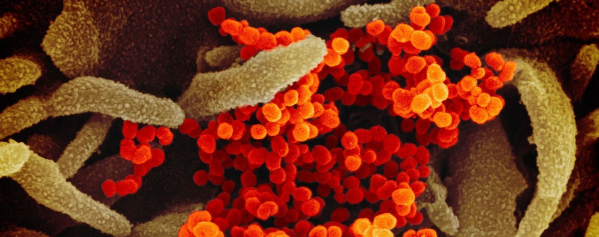 Это не то, о чем вы подумали, а коронавирус на ткани