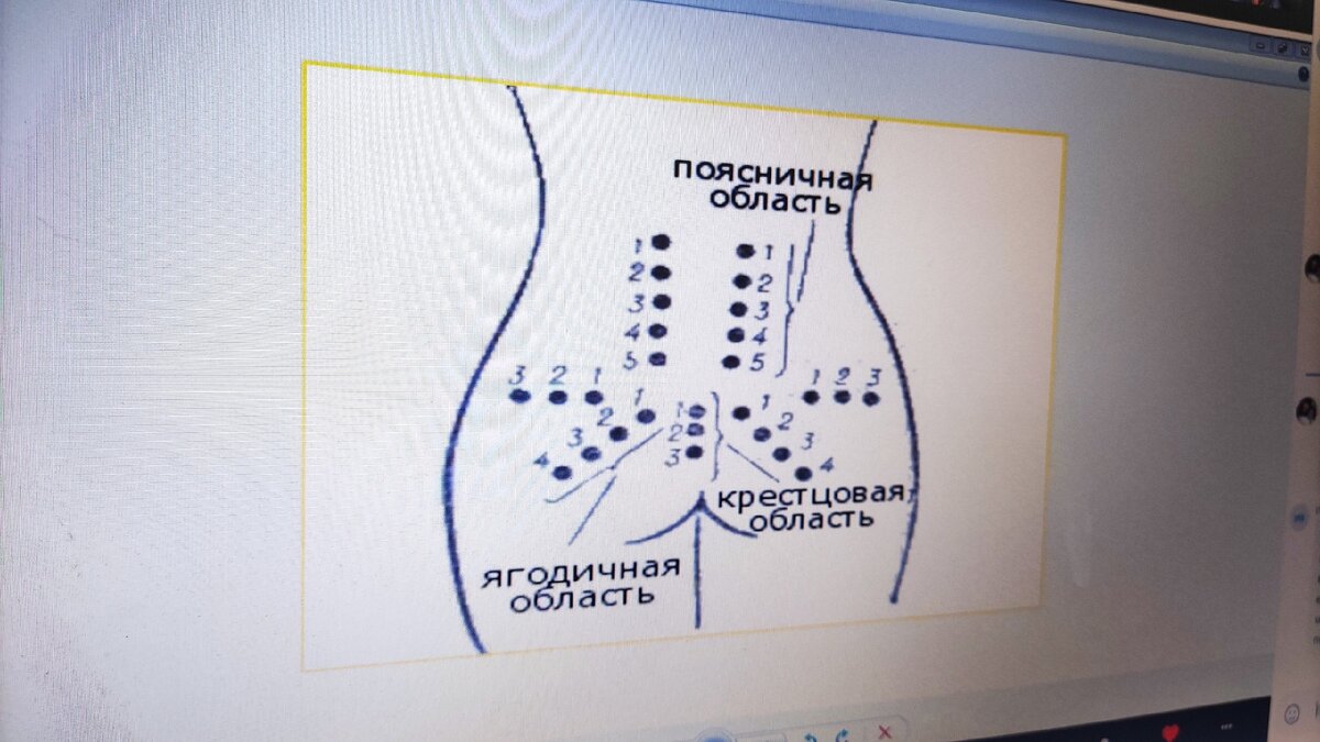 Курсы для беременных. Урок 5: Точечный массаж в родах | Мама Таня | Дзен