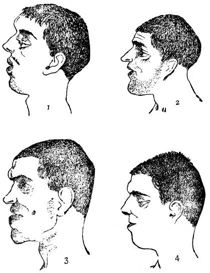 Правильная форма черепа. Форма черепа определяет. Форма черепа определяет. Форма черепа определяет. Чезаре ломброзо теория.
