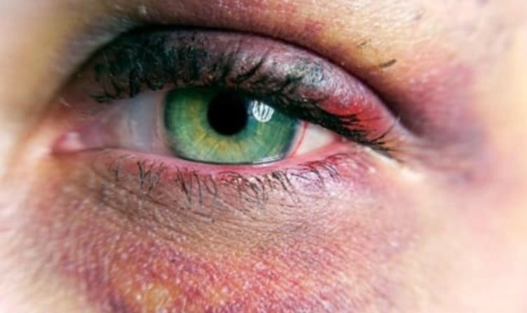 1.	Лекарства