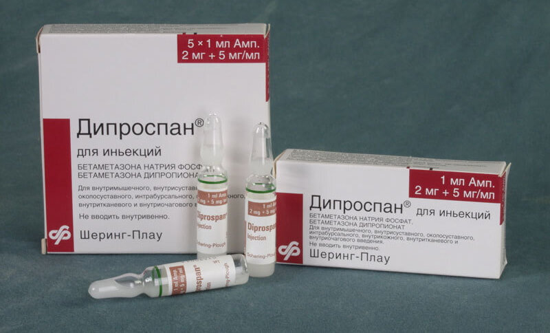 Применение дипроспана при пяточной шпоре дает сильный обезбаливающий эффект.