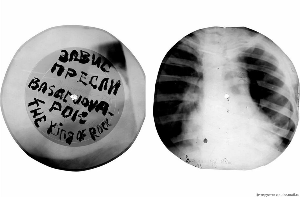 Что Вам приходит первым на ум, когда Вы слышите слово «рентген»? Наверное, медицинское исследование, темная комната и ученый, предложивший пользоваться X-лучами и снимками.-6