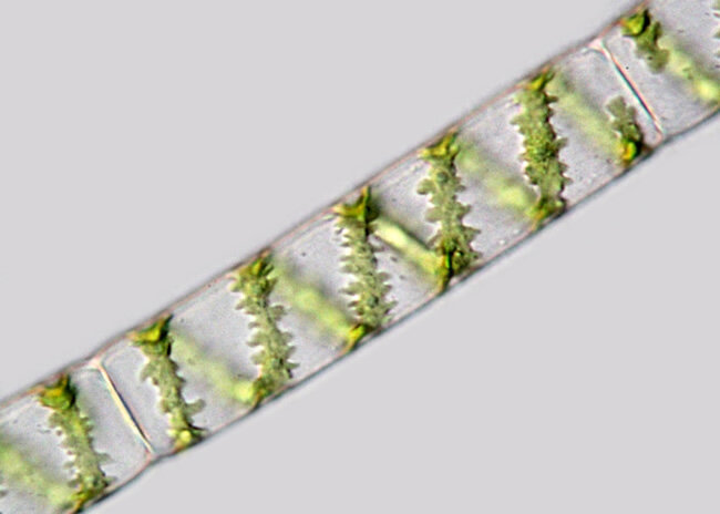 Spirogyra под микроскопом