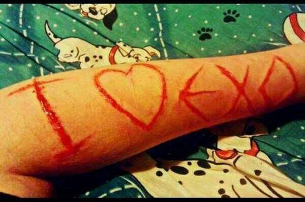 Сасэн-фанатка вырезала у себя на ноге <<признание в любви>> к группе EXO.
