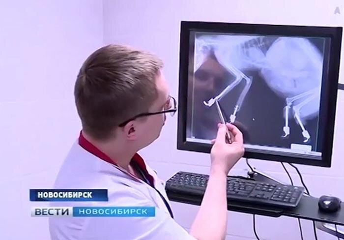 Основу протезов составляют титановые штифты, которые прикреплены к  костям. Часть протезов, которая связана с кожей и костью, является  губчатой, чтобы позволить ткани расти вокруг нее.